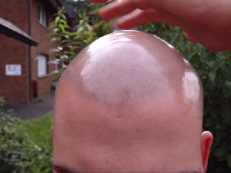 Best-Care-Tips-for-Your-Bald-Head